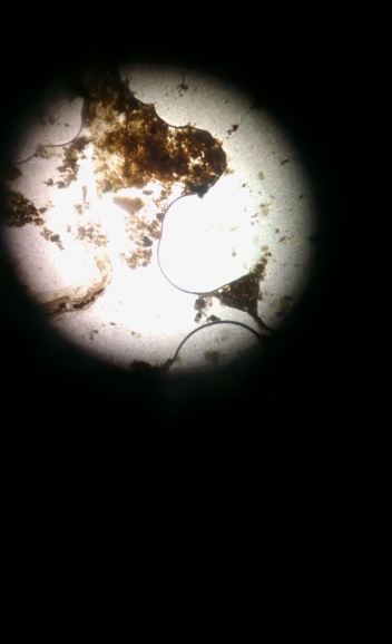 A worm through a microscope.